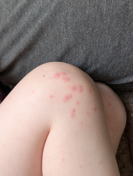 Can anyone identify rash