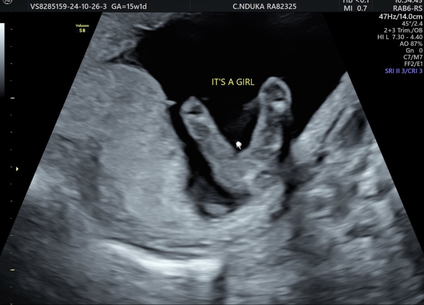 Help! Gender scan - is it correct?