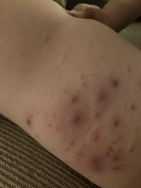 To ask for advice re this rash