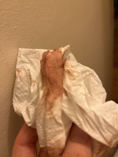 Is this implantation ?