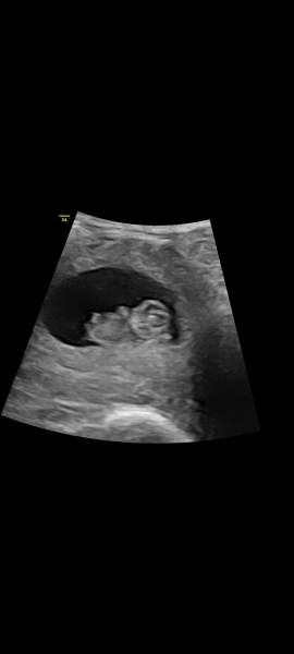 Gender guess?