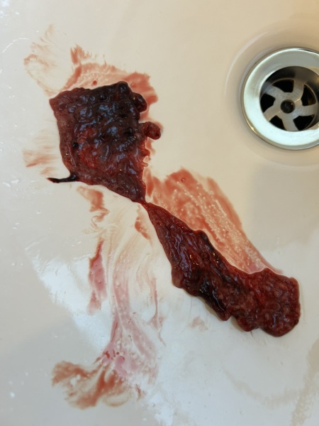 Weird thing came out of my body (Pic)