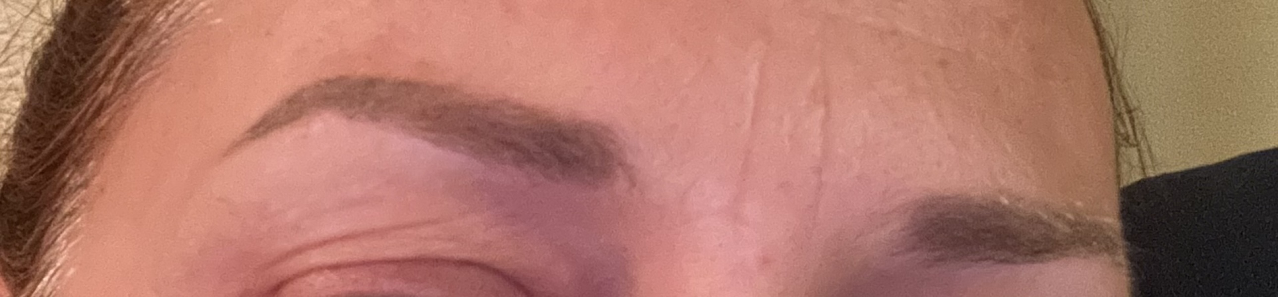 Sparse eyebrows post menopausal what pain free treatment would you recommend please?