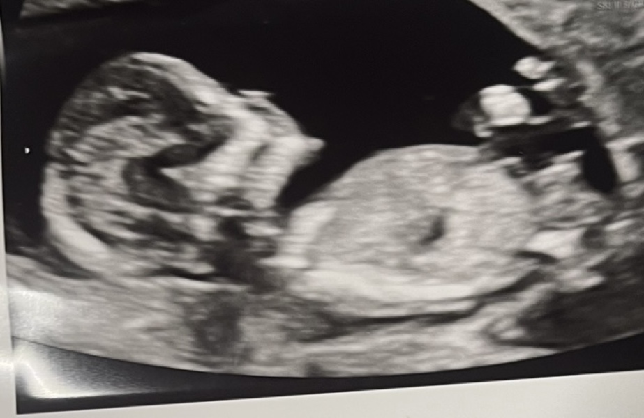 Boy or girl