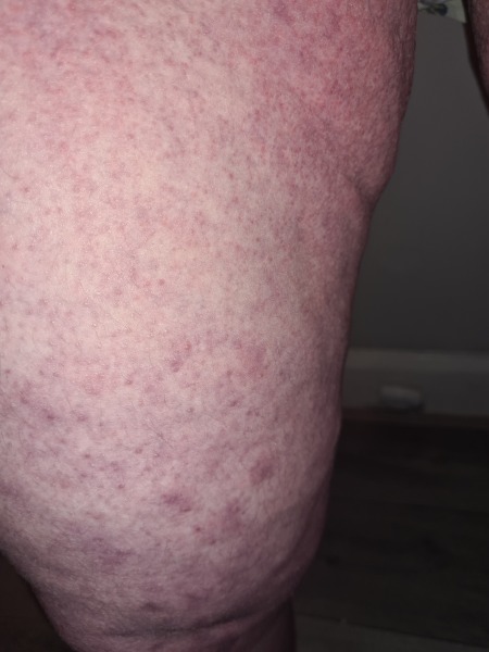 Chub Rub