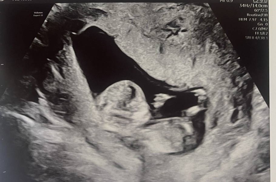 Help guessing gender