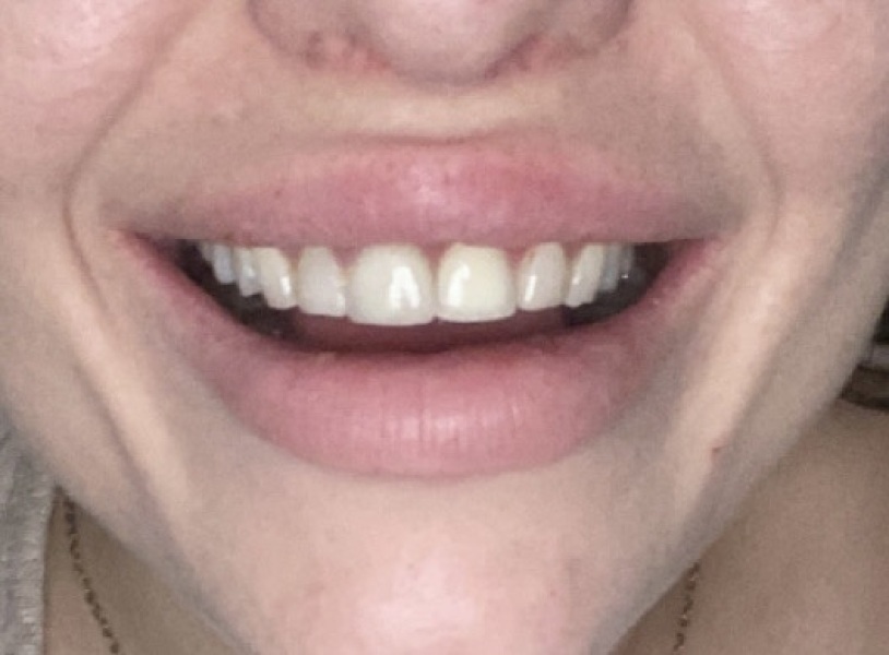 I hate my teeth. What are my options