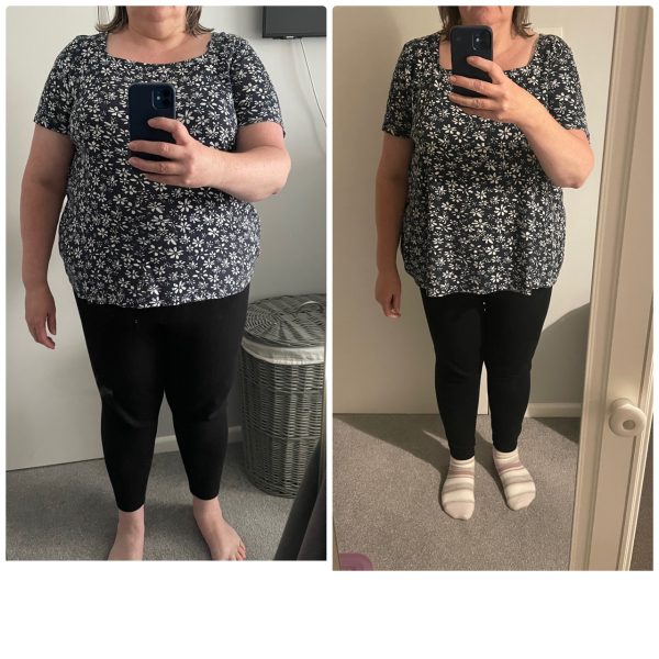 Mounjaro - Before & after results