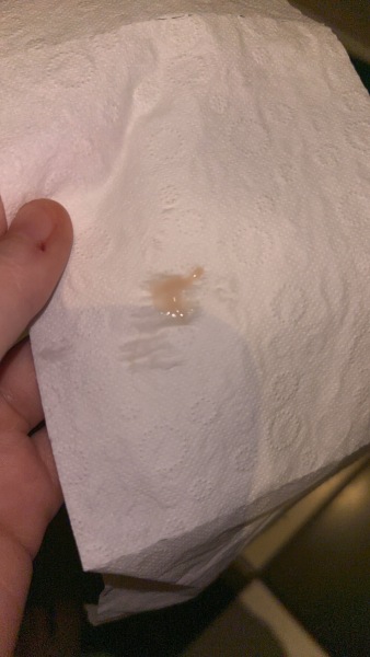 TW baby loss/miscarriage/new pregnancy