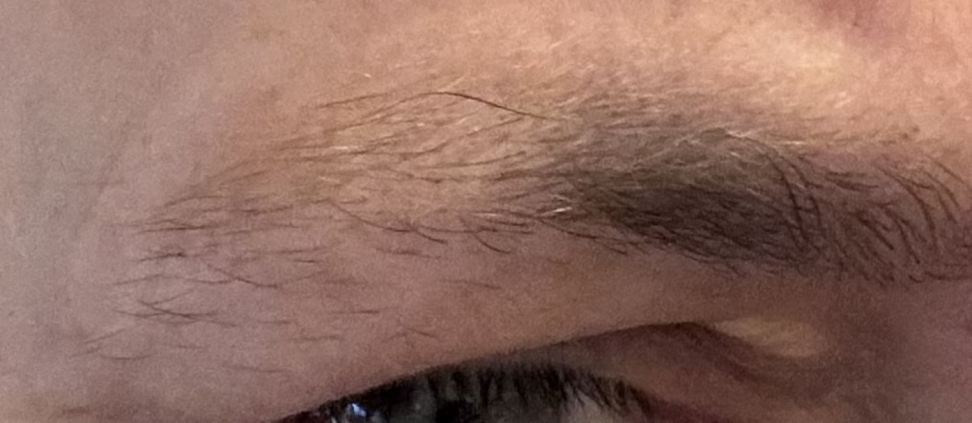 Sparse eyebrows post menopausal what pain free treatment would you recommend please?