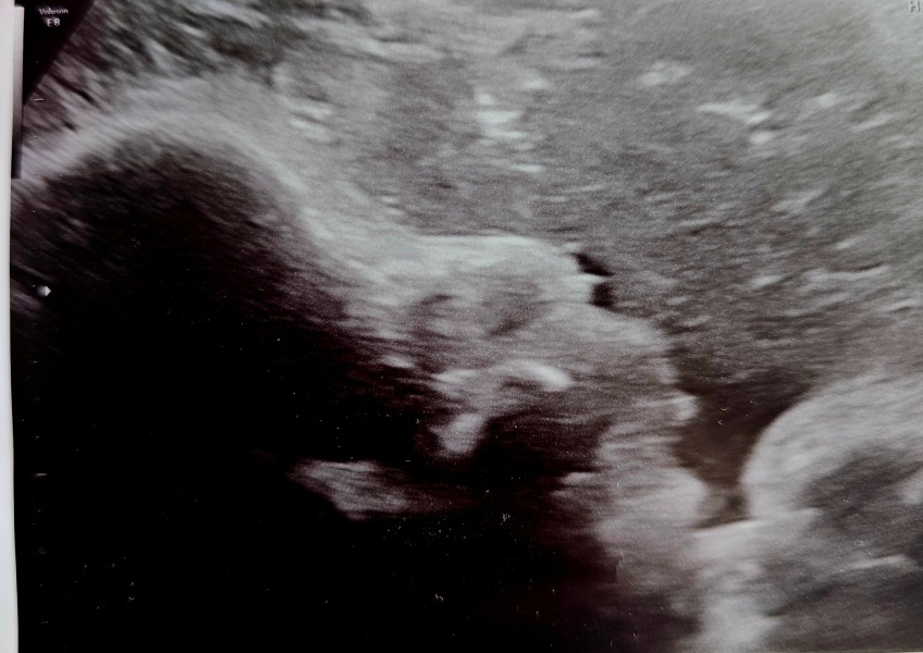 Looking for advice about baby scan photos!