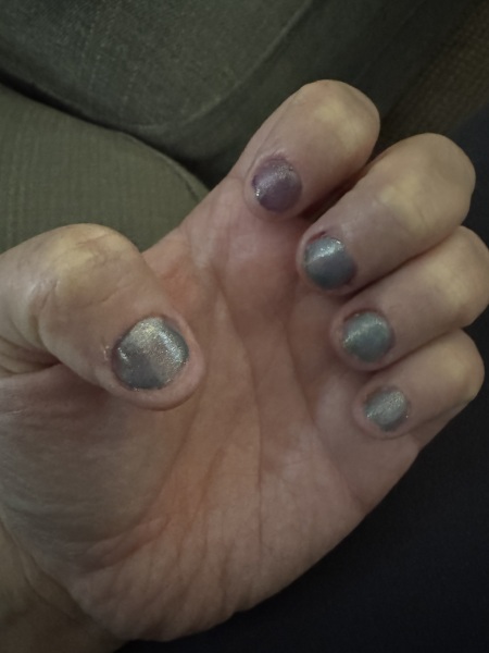 To Ask How To Stop Biting Nails
