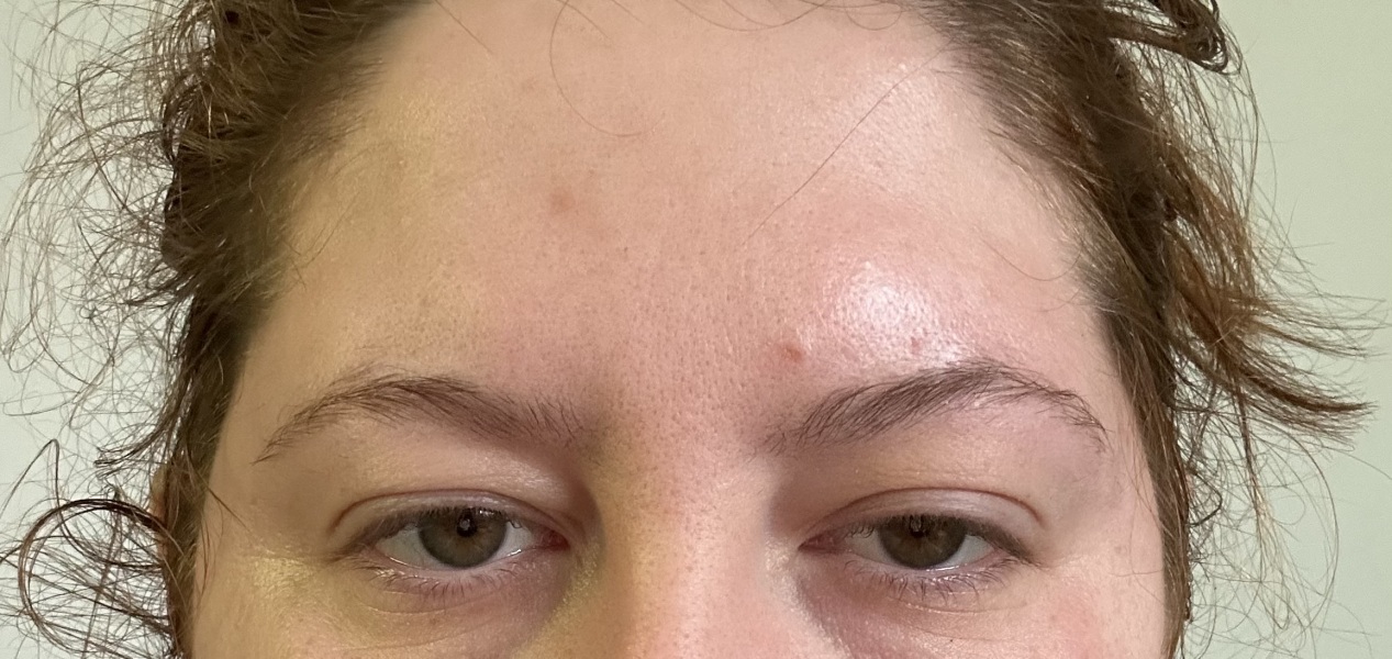 Agony with sinusitis… AIBU to ring 111