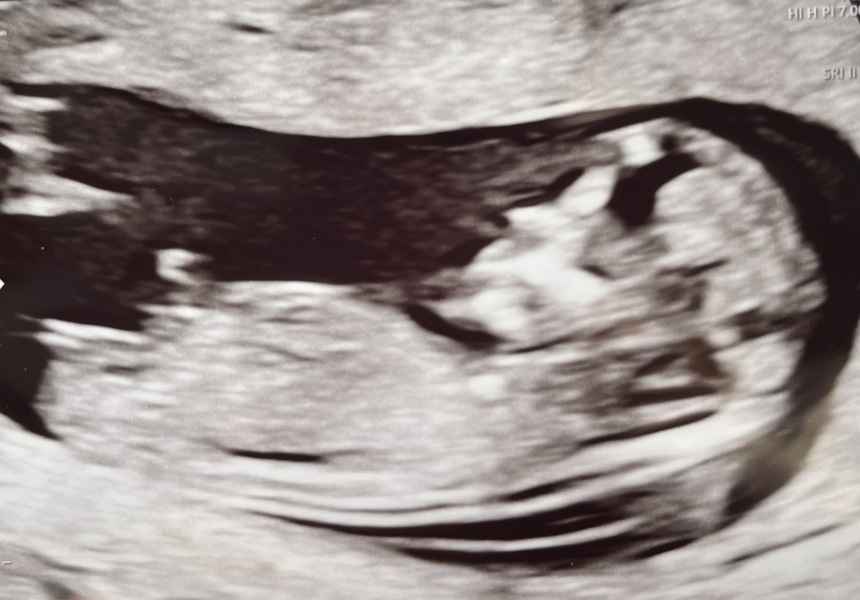 Confirmed gender?