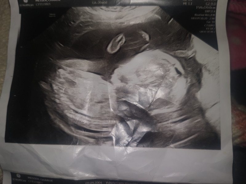 Gender prediction? ❤️