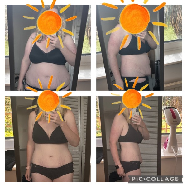 Mounjaro - Before & after results