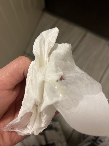 17 weeks snotty discharge?