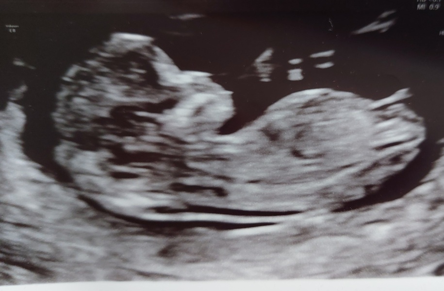 Due April 2025 ✨