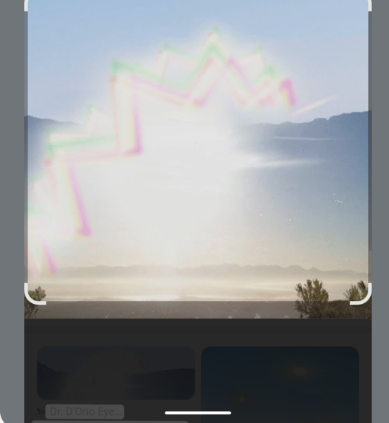 Bright 'blob' in vision, could this be related to aura migraine?