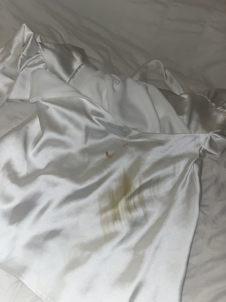 Stain removal