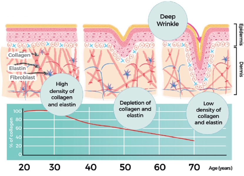 To not want to age gracefully? Can anyone recommend an anti aging cream that actually works?