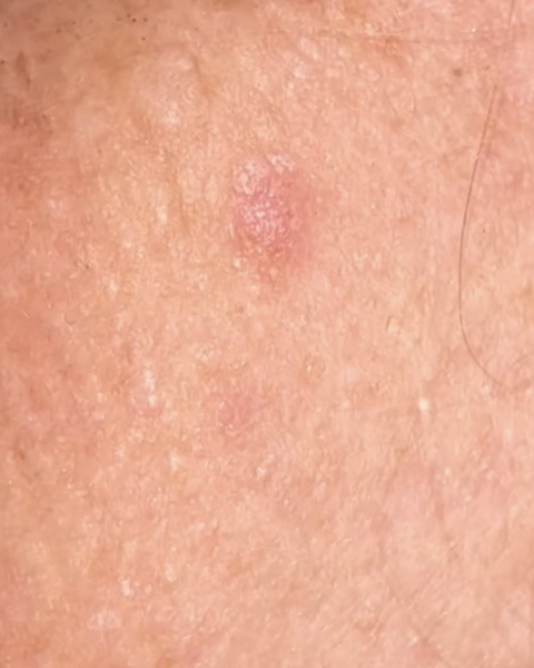 Husband is saying it’s nothing, but what is this on my face?