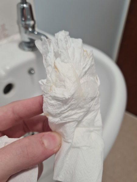 Is this my mucus plug starting? Warning: Photo included!