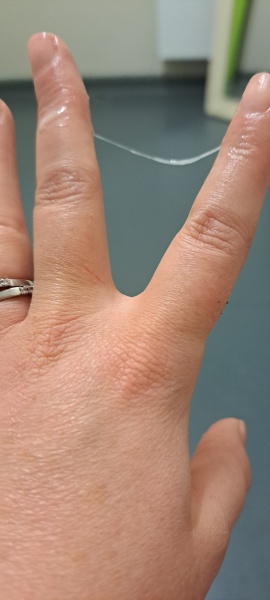 Cycle crazy. Where do you think I am in it based on Cm?