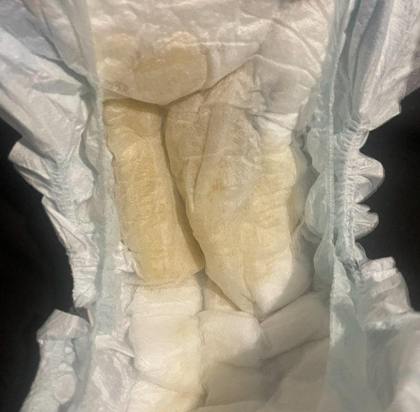 Baby UTI ... please help *pics of nappy attached)