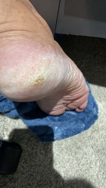Help with my foot please