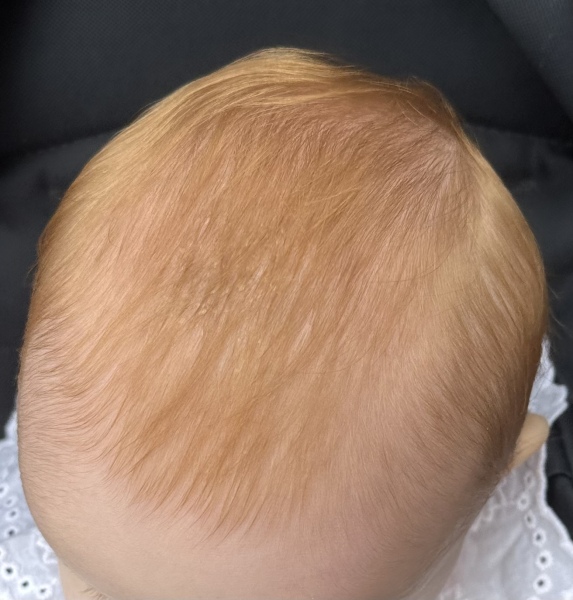 Red headed baby