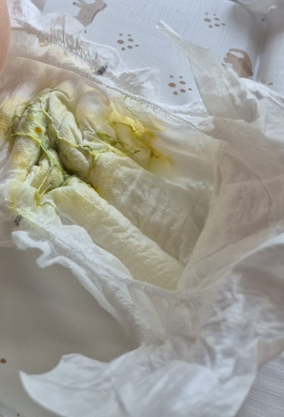 Breastfed 3 month old weird poo