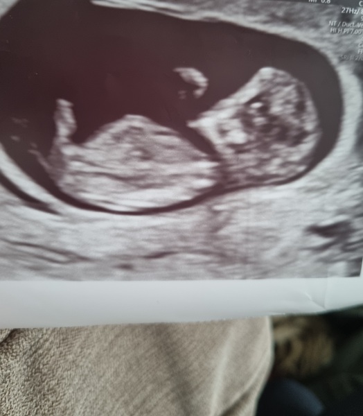 Boy or girl?