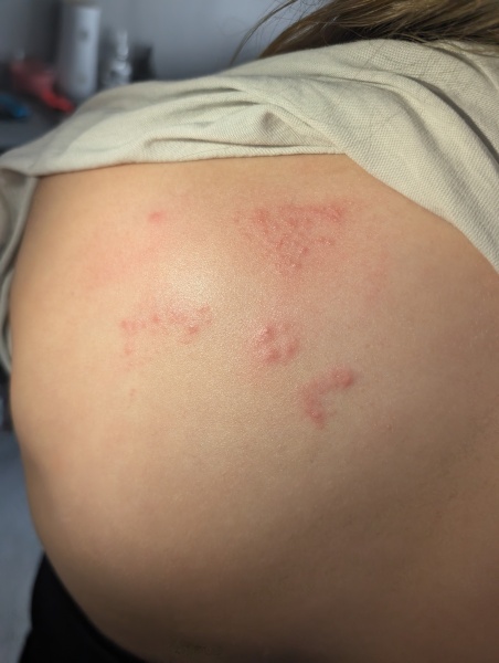 10 year old daughter has a rash