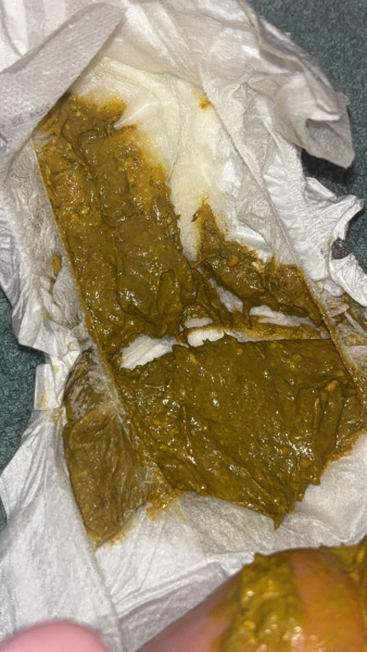 Normal poo on apatmil pepti