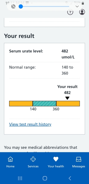 Low Ferritin