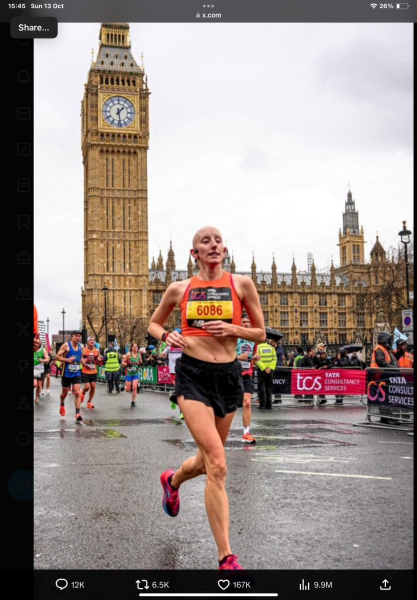 Women with alopecia harassed in woman's toilets at airport
