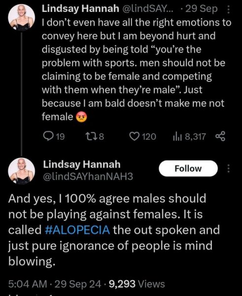 Women with alopecia harassed in woman's toilets at airport