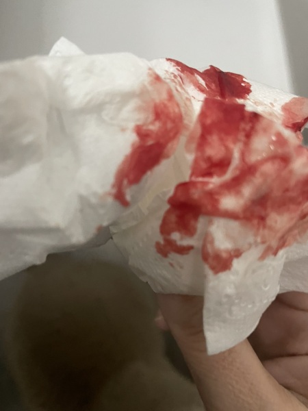 Bleeding when going to the toilet (TMI photo included)
