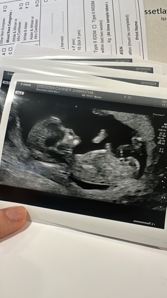 Can anyone tell the gender of our baby?
