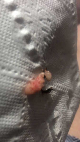 Any idea what this could be...GROSS PIC INCLUDED
