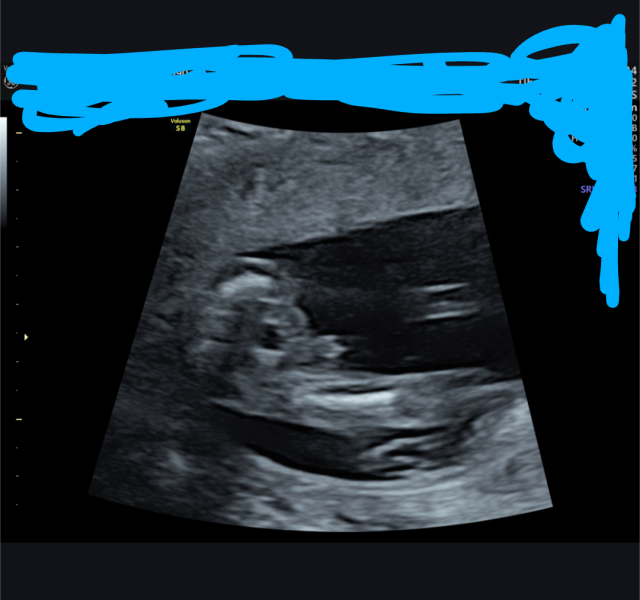 Gender of scan image