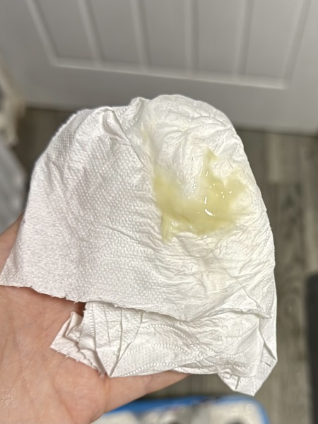 Mucus plug or discharge??
