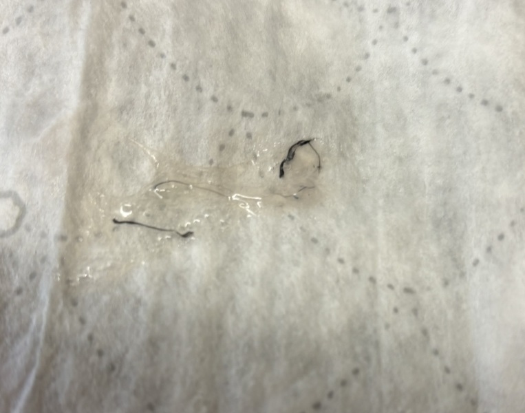 Coughed up black string? (Photo attached)
