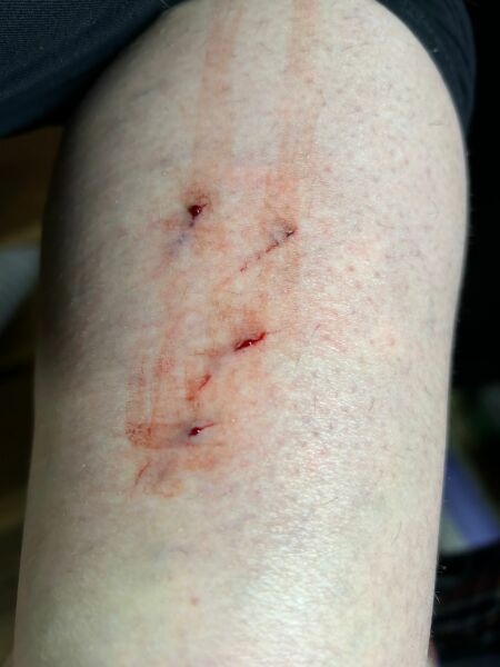 My cat has quite badly got my leg