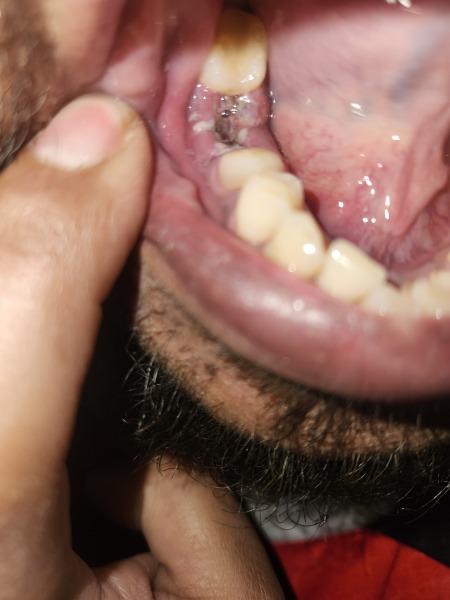 Any dentists around? Photo TMI !