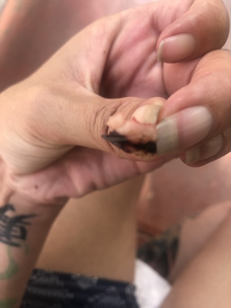 Any idea what this could be...GROSS PIC INCLUDED