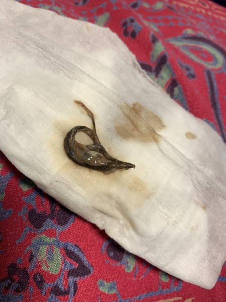 Gross unidentified blob