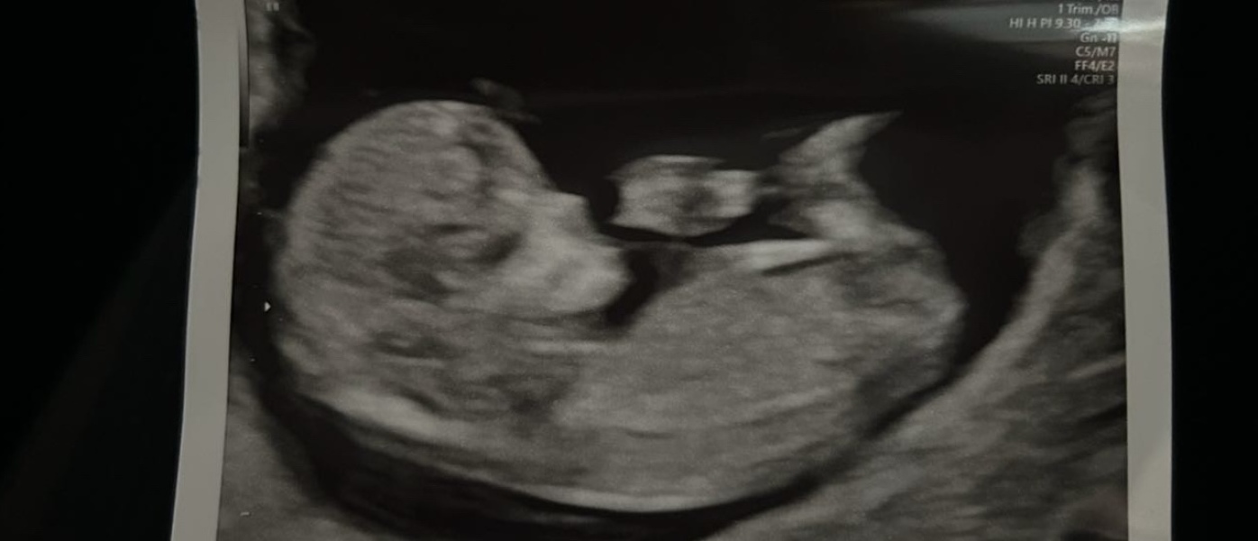Nub theory guesses?? 11 weeks 4 days!
