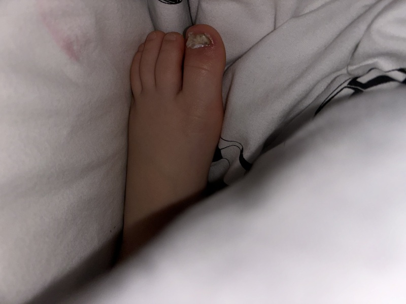Does this warrant a&e, infected toe?